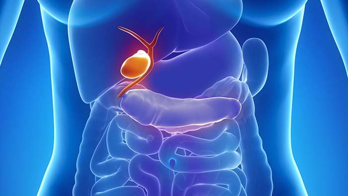 Biliary Pancreatic Diversion with Duodenal Switch Dallas, Fort Worth