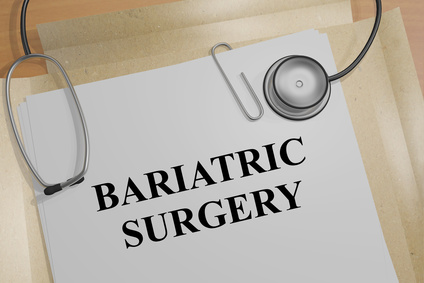 A Brief Guide to Bariatric Surgery