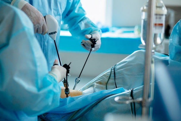 4 Types of Minimally Invasive GI Surgeries Available in Fort Worth